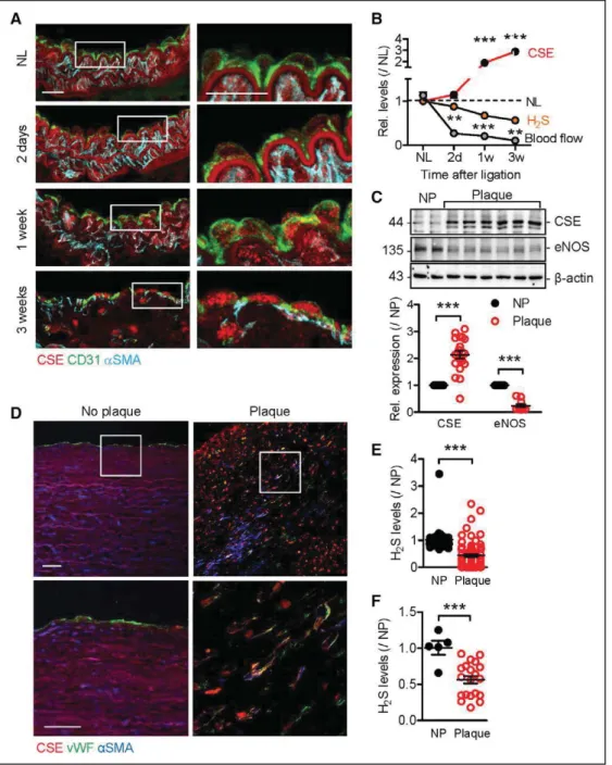 Figure 3. Cystathionine γ lyase (CSE) expression in the vascular wall.  