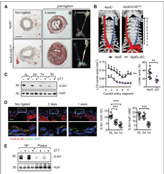 Figure 5. Characterization of atherosclerosis development in endothelial cell (EC)–speciﬁc cystathionine  γ  lyase (CSE) knockout mice