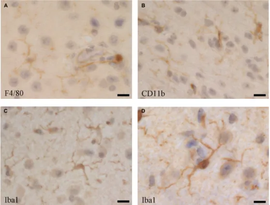 Figure 2: Microglia cells visualised by immune histochemistry in the mouse brain using antibodies directed against