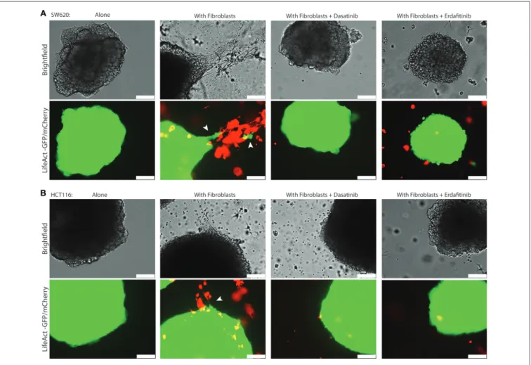 FIGURE 3 | Dasatinib and Erdafitinib inhibitors reduce fibroblasts-induced SW620 cancer cell invasion in vitro under 3D condition