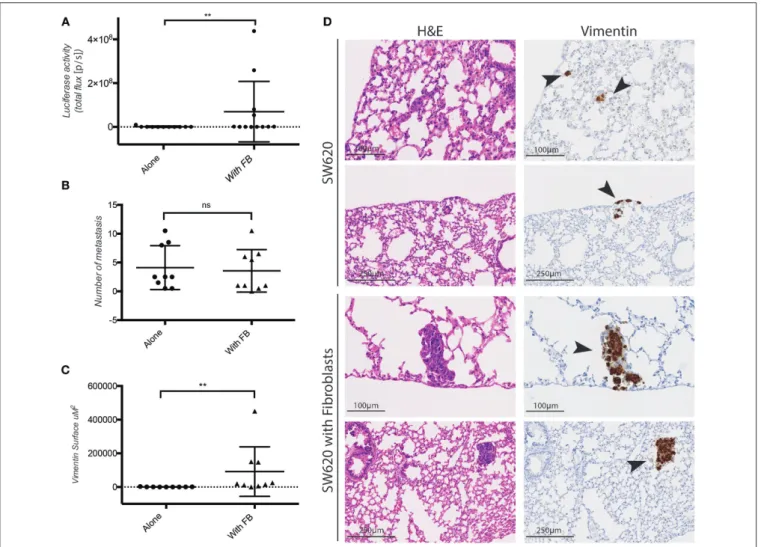 FIGURE 4 | Fibroblasts promote SW620 colorectal cancer cell metastasis. (A) Ex-vivo Luciferase activity in the lung of mice injected with SW620-A299 ± fibroblasts.