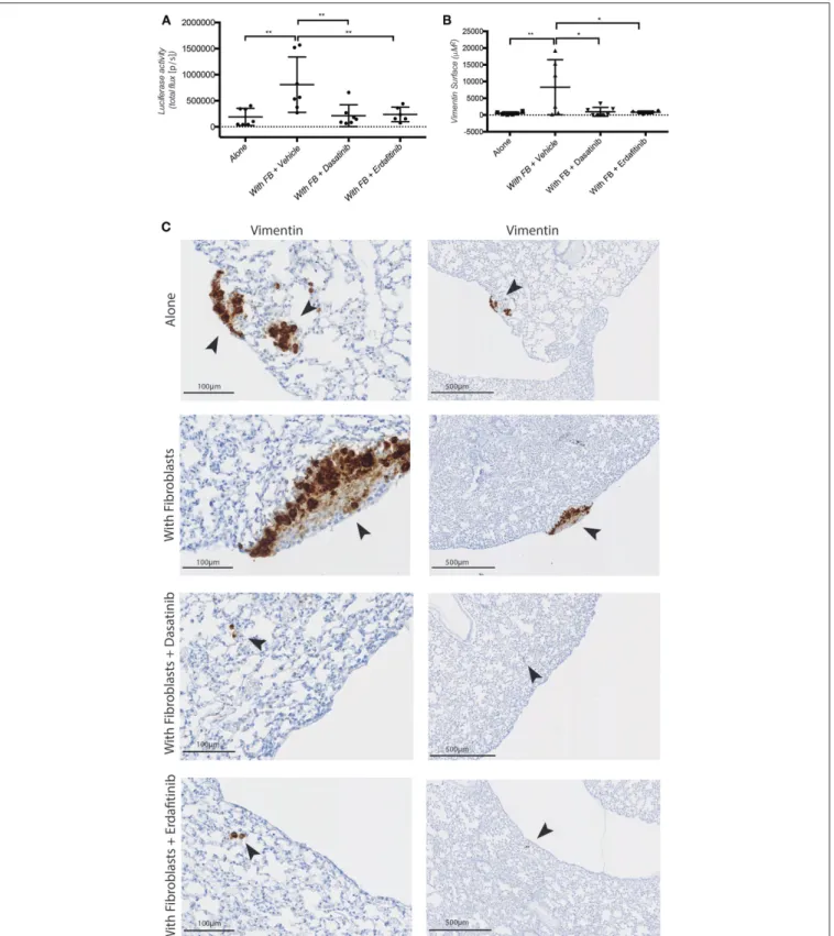 FIGURE 5 | Dasatinib and Erdafitinib suppress fibroblasts-induced metastasis in vivo. (A) Ex-vivo Luciferase activity in the lung of mice orthotopically injected with SW620-A299 cells ± fibroblasts treated with Dasatinib or Erdafitinib or vehicle only as i
