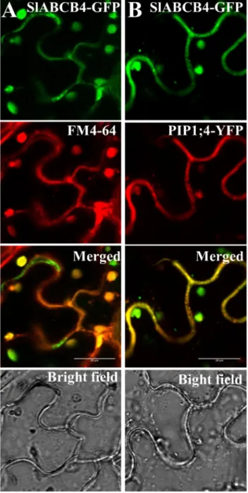 Figure 2. Subcellular localization of SlABCB4 in Nicotiana benthamiana epidermal cells