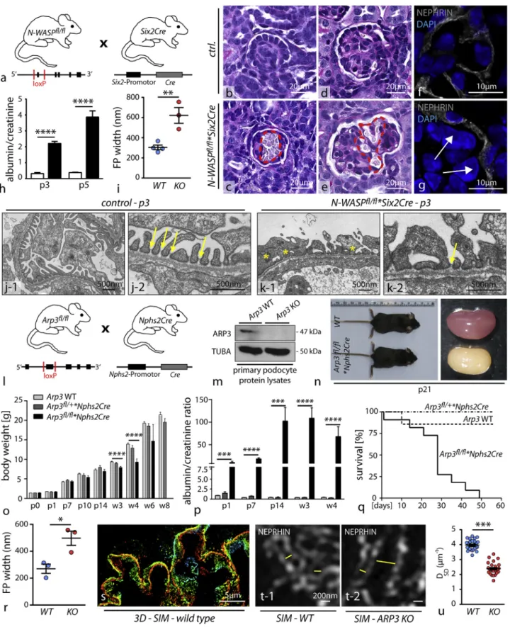 Figure 2. N-WASP and ARP3 Are a Prerequisite for Ordered Podocyte Development In Vivo