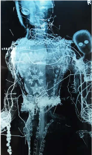 Abb. 2 – Röntgenaufnahme   Bilder T.  Becker; S. Dobler