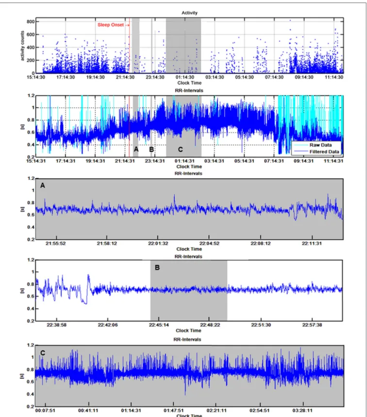 FIGURE 1 | Typical example of accelerometer (top panel) and R-R interval recordings (second panel from top) of one child