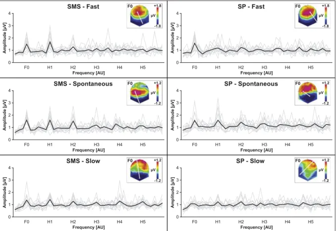 Fig. 5. SSEPs for each tempo of the SMS and SP conditions. The thin grey power spectra represent each participant and the thick black power spectra represent the inter-individual averages.