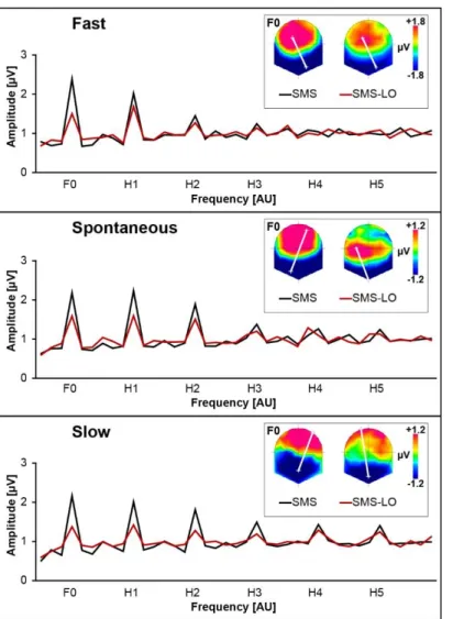 Figure S1 – SSEPs for each tempo of the synchronization conditions before (SMS) and after (SMS- (SMS-LO) subtraction of the LO signal