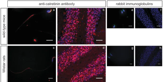 Fig. 1. Calretinin detection (antibody: 214 102, Synaptic Systems) in C57Bl6 (WT) mice and Wistar rats spermatozoa