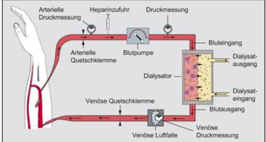 Abbildung 1 Prinzip der HD. (Brandt &amp; Menche, 2013)