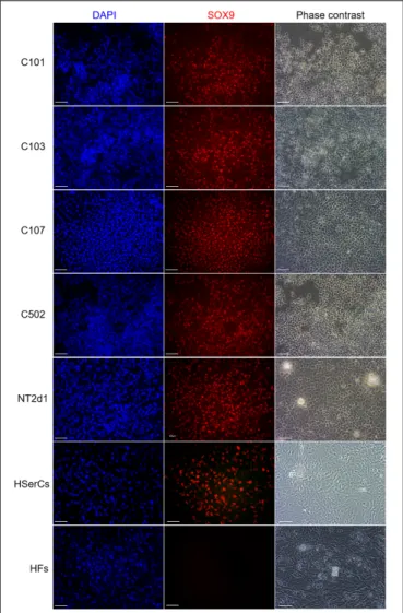 FIGURE 7 | Immunofluorescence staining of SLC colonies with antibodies against SOX9. Mounting medium contains DAPI stain