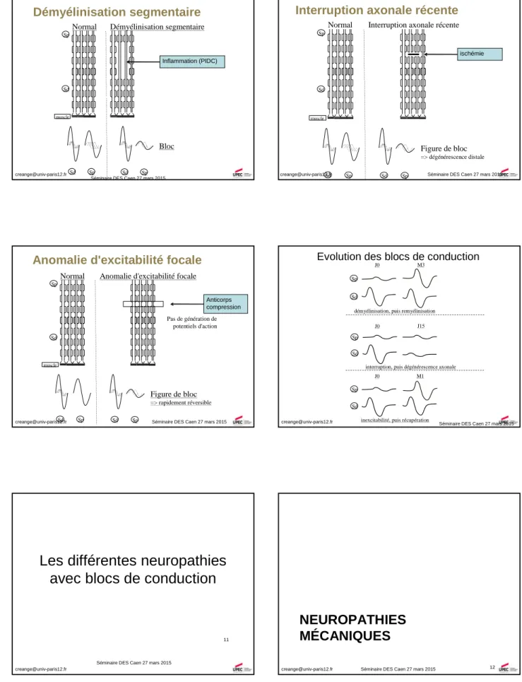 Figure de bloc => rapidement réversible Pas de génération depotentiels d'action Anticorps compression