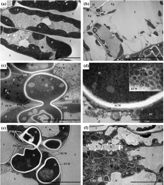 Figure 7.  Transmission electron micrographs of hyphae of Cryptophyllachora eurasiatica in Ambrosia  artemisiifolia