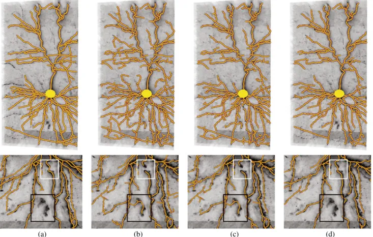Fig. 6 Reconstructions in a brightfield micrograph. The top row depicts the whole image stack and the bottom one an enlarged portion of it