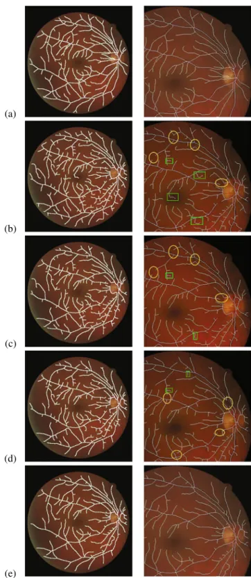 Fig. 8 Example result for a retinal image from the DRIVE database. The first column depicts the whole image and the second an enlarged portion of it