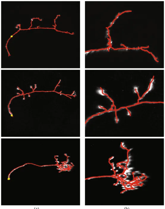 Fig. 9 Olfactory projection fibers. a Maximum intensity projections of three image stacks with the  reconstruc-tions overlaid