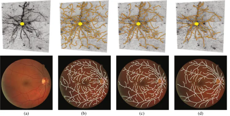 Fig. 1 Delineation results in 3D (top row) and 2D (bottom row).