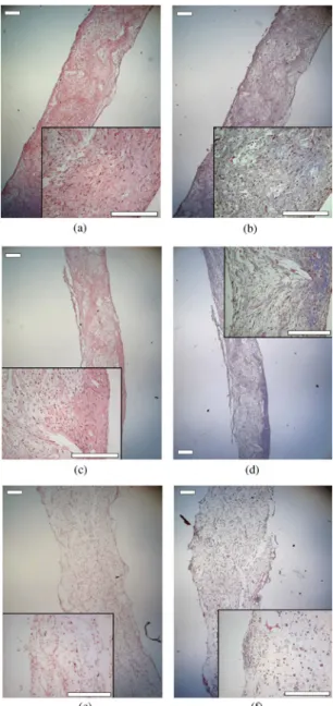 FIGURE 7. Representative sections of the valve leaflet tis- tis-sues after 4 weeks of culturing stained with H&amp;E (a,c,e) and Trichrome Masson (b,d,f)
