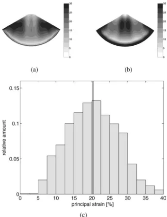 FIGURE 9. The dynamic strain distribution after 4 weeks of culturing at the upstream (a) and downstream (b) surfaces of the leaflets at an applied dynamic transvalvular pressure difference of 37 mm Hg