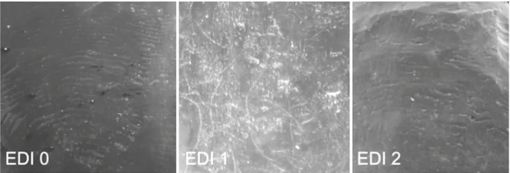 Figure 1. Enamel damage indices (EDI): EDI 0 no damage, EDI 1 scratches, EDI 2 serious damage, at 50× magnification Abbildung 1