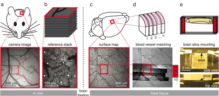 Fig. 3 Preparation of fixed coronal brain slices and registration to the volume of interest