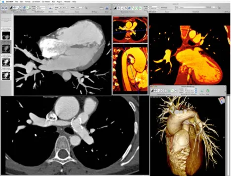 Fig. 3 Examples of advanced image visualization and processing tools for multi-dimensional and multimodality imaging showing different display and visualization tools applicable for four-dimensional dynamic cardiac CT images