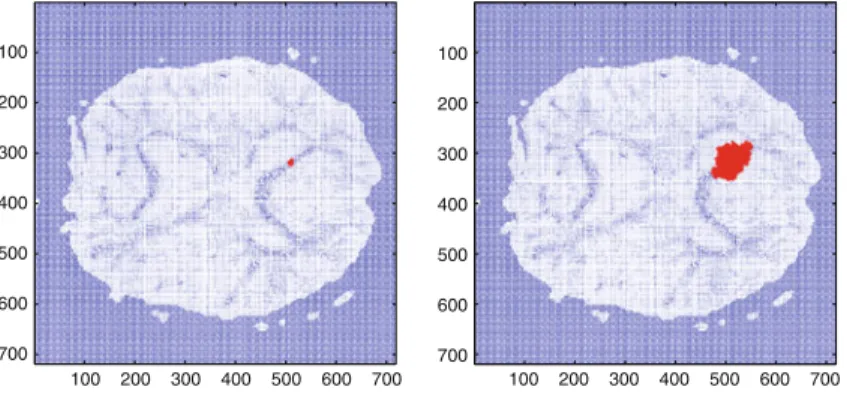 Fig. 7 Brain’s fiber track effect on glioma growth. We use a LGCA of a proliferating cancer cell population moving in a tensor field provided by clinical DTI data, representing the brain’s fiber tracks.