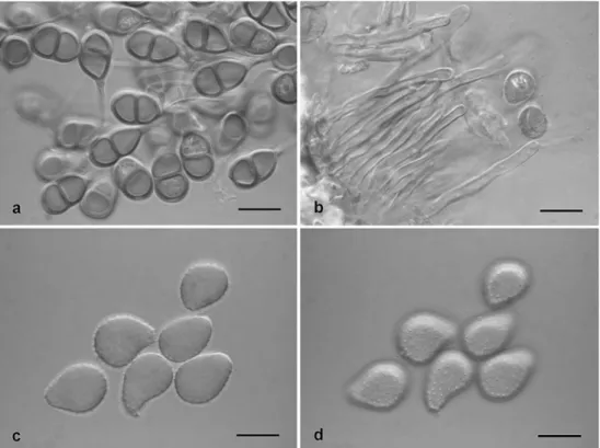 Fig. 5 Puccinia parianicola. a Teliospores. b Peripheral paraphyses of uredinia. c Urediniospores, optical section.