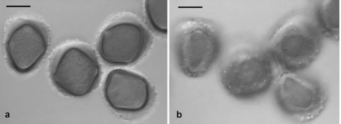Fig. 1 Achrotelium lucumae (FG09/27), urediniospores. a Optical section. b Focus on spore surface