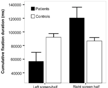 Figure 2 shows the cumulative  W xation duration for the left and right screen-half. Repeated-measures ANOVA yielded a signiWcant main eVect for “side” [F(1,21) = 9.42, P < 0.01] and a signi W cant interaction “side £ neglect”