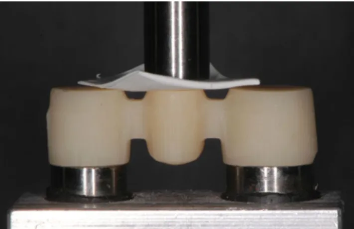 Fig. 1 FDP on the steel model during fracture load measurement