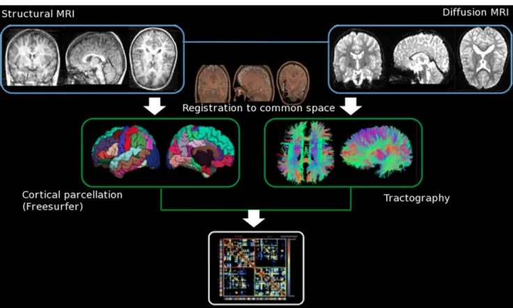 Fig. 4 Typical example of a tract-based spatial statistics (TBSS) analysis, where two groups of DTI (FA maps) images are compared.