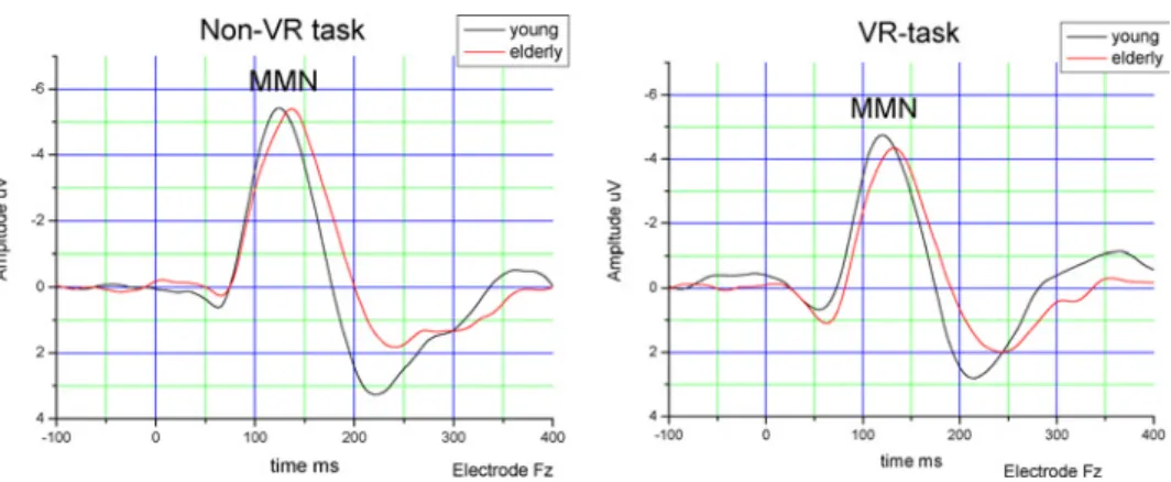 Fig. 4. Grand average of difference curves (responses to rare tones minus responses to frequent tones).