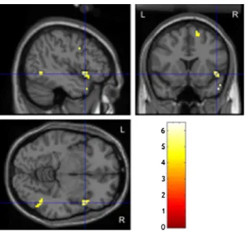 Table 1 Local maxima of cerebral blood flow change for experimental contrasts (threshold p <0.001 voxel level and p<0.05, cluster level, uncorrected, with the threshold of reporting being a minimum 20 voxels; BA 0 Brodmann’s Area