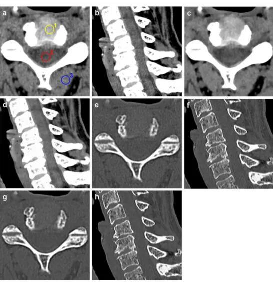 Fig. 1 A 50-year-old woman with chronic neck pain, who belongs to the standard-dose group