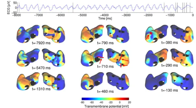 Fig. 3 Maps of transmembrane potentials during simulated meander- meander-ing AF directly precedmeander-ing spontaneous termination (see also Online Resource 1)
