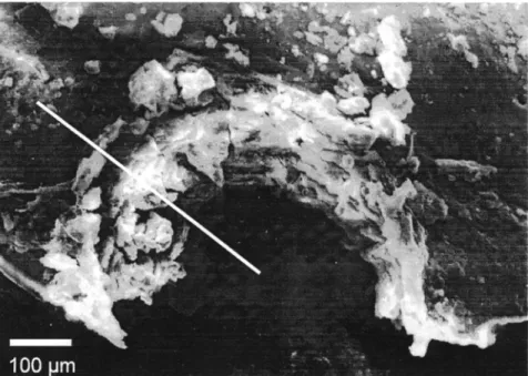 Fig.  2.  Scanning electron micrograph picture of half  a  hole drilled with  17 laser pulses of  H=12 J  c m   - 2   into the cochlea bone