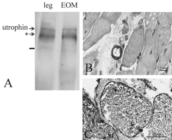 Fig. 2 Utrophin was detected with Western blot in leg muscles and extraocular muscles (EOM) (a)