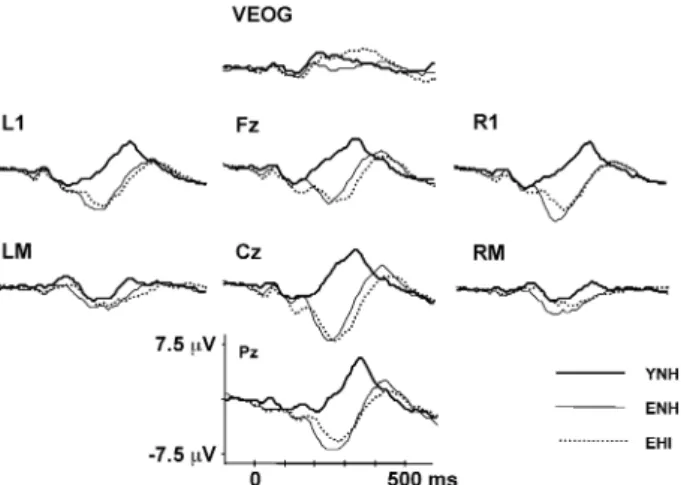 FIG. 10. Grand mean difference waveforms of the attended con- con-dition in response to the 1016-, 1032-, and 1064-Hz targets at  elec-trode site Cz for the three subject groups (YNH, ENH, EHI).