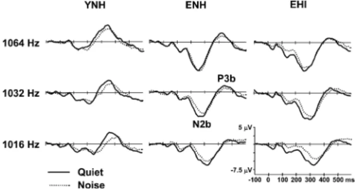 FIG. 11. Grand mean difference waveforms of the attended condition for the three stimulus targets and the three subject groups as a function of the noise condition (quiet, contralateral cafeteria noise) at electrode site Cz.