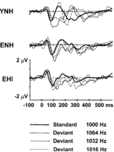 FIG. 12. Grand mean responses to the standard and the three deviant stimuli of the unattended condition at electrode site Fz for the three subject groups.