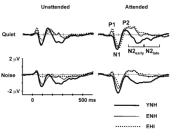 FIG. 4. Grand mean standard waveforms of the three subject groups (YNH, ENH, EHI) from the unattended quiet condition at all eight electrode sites.
