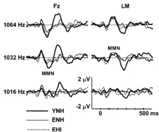 FIG. 7. Grand mean difference waveforms of the unattended quiet condition in response to the 1016-, 1032-, and 1064-Hz deviants at electrode sites Fz and LM for the three subject groups (YNH, ENH, EHI).