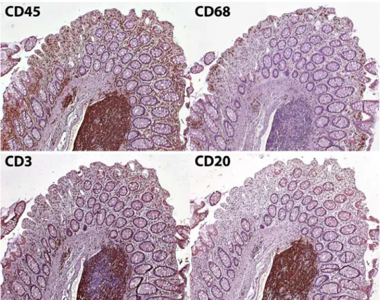 Fig. 1 Immune cells in the intestinal mucosa.  Immunohis-tochemical detection (brown staining) of total leukocytes (CD45+), macrophages (CD68+), T lymphocytes (CD3+), and B cells (CD20+) in the same section of the human colonic mucosa