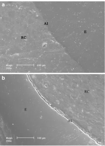 Fig. 2 Representative scanning electron microscopy micrographs images (original magnification ×200) of “ continuous margins ” (a) and “ non continuous margins ” (b) at the dentin-composite bonded interface ( E enamel, RC resin composite, AI adhesive interf
