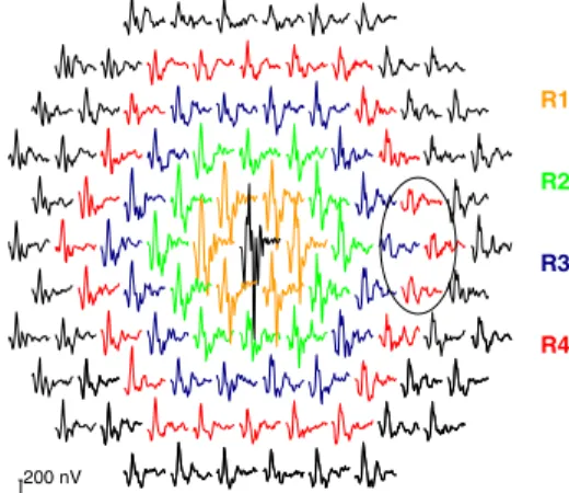 Fig. 1 Definition of the nine used retinal areas. In the left trace array the rings in which the responses are averaged are color coded