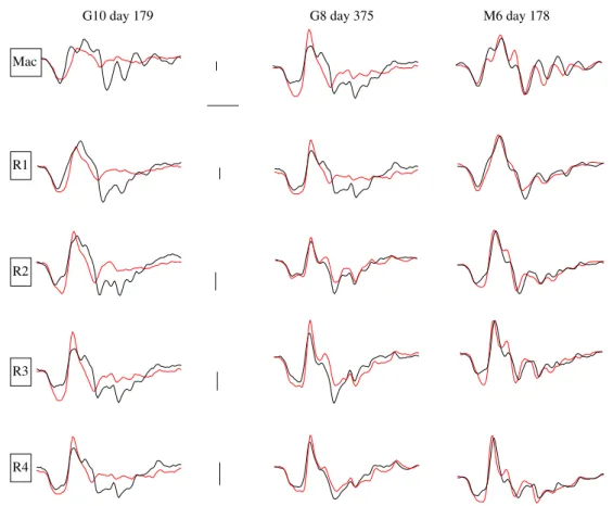 Fig. 4 Original responses to 99% contrast stimuli measured about 180 days after the last coagulation