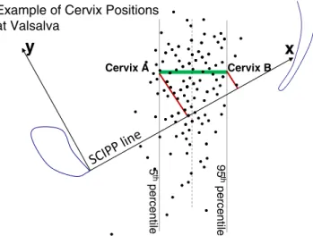 Fig. 3 The points represent the distribution of 149 cervix locations at maximum strain for an average θ -SCIPP line strain angle of 29°