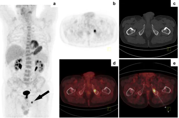 Fig. 2 Follow-up examination of a 67-year-old patient with a history of malignant melanoma
