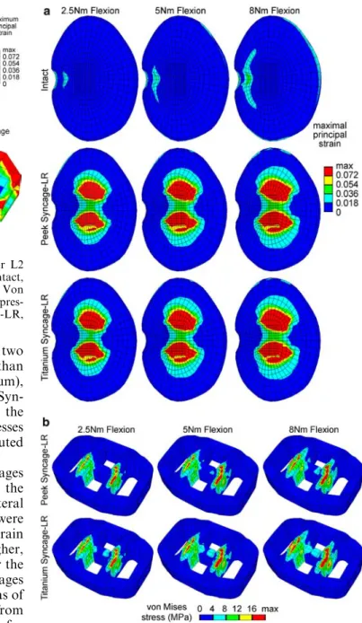 Fig. 4 a Maximal principal strain distribution in the inferior L2 endplate due to 1,000 N of compression